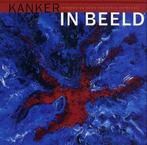 Kanker in beeld 9789071123719 Jan Taal, Boeken, Verzenden, Gelezen, Jan Taal