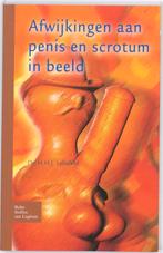 Afwijkingen aan penis en scrotum in beeld 9789031352920, Boeken, Verzenden, Gelezen, Leliefeld