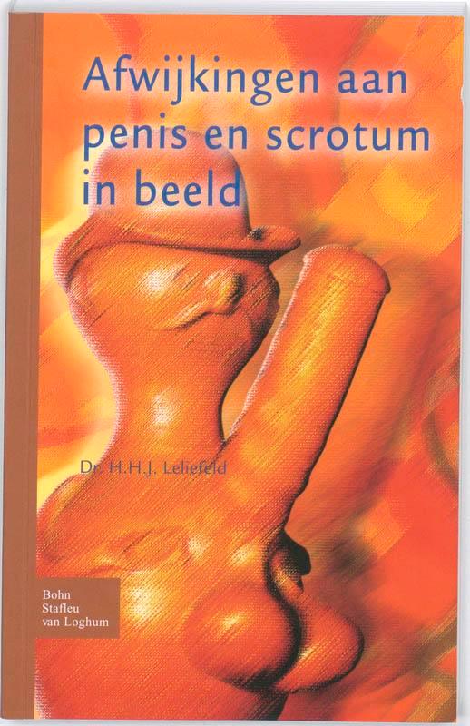 Afwijkingen aan penis en scrotum in beeld 9789031352920, Boeken, Wetenschap, Gelezen, Verzenden