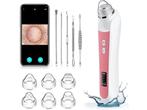 Ottleba Blackhead Remover Vacuum - 1080P HD-Camera - 17 x, Elektronische apparatuur, Verzenden, Nieuw