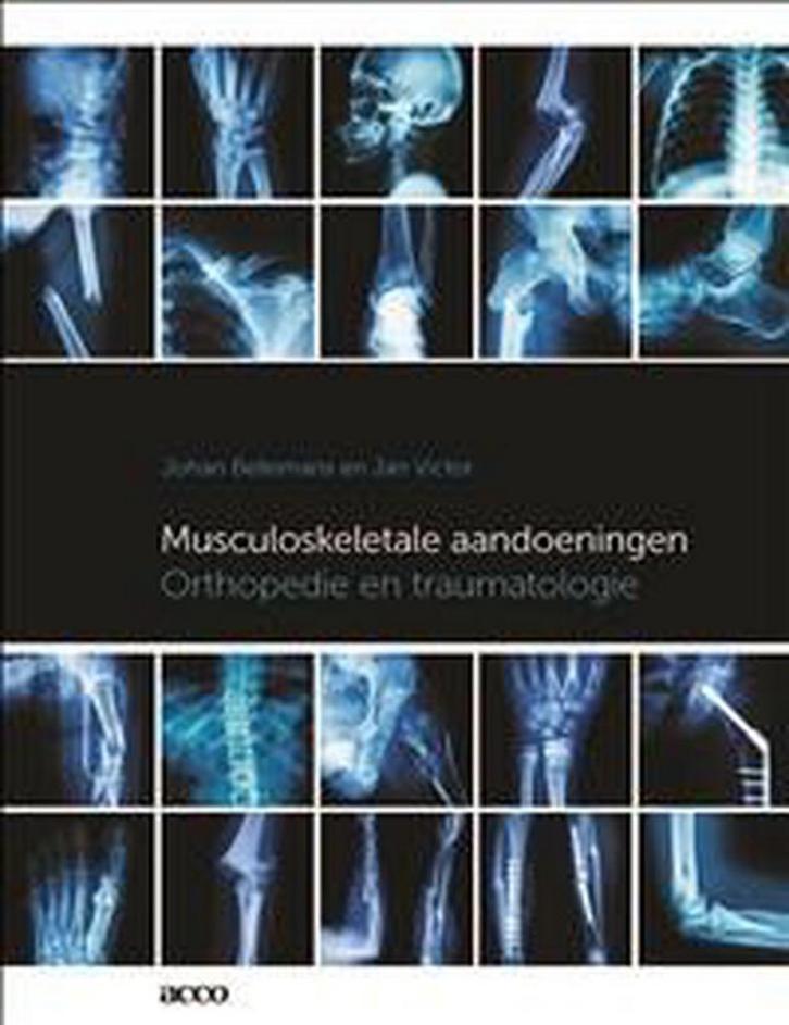 Musculoskeletale aandoeningen 9789463443890 Johan Bellemans, Boeken, Wetenschap, Gelezen, Verzenden