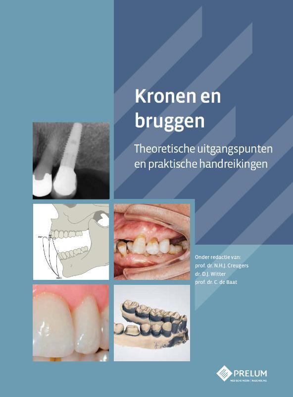 Kronen en bruggen 9789085621348, Boeken, Wetenschap, Zo goed als nieuw, Verzenden