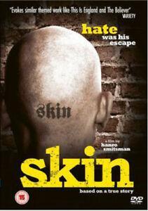 Skin DVD (2011) John Buijsman, Smitsman (DIR) cert 15, Cd's en Dvd's, Dvd's | Overige Dvd's, Zo goed als nieuw, Verzenden