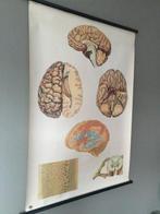 Deutsches Hygiëne Museum Dresden - Ancienne planche