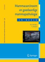 Mammacarcinoom en goedaardige mammapathologie in beeld, Boeken, Verzenden, Zo goed als nieuw, T. Wobbes