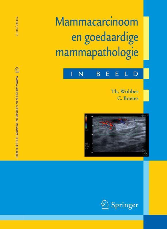 Mammacarcinoom en goedaardige mammapathologie in beeld, Boeken, Wetenschap, Zo goed als nieuw, Verzenden