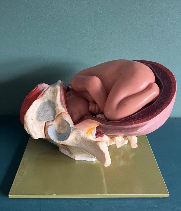 Anatomisch model - Somsoplast - 1970-1980 - THE FIRST BIRTH, Antiek en Kunst, Antiek | Wandborden en Tegels