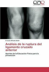 Analisis de La Ruptura del Ligamento Cruzado Anterior., Boeken, Overige Boeken, Zo goed als nieuw, Verzenden