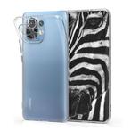 Xiaomi Mi 11 Transparant Hoesje - Silicone Clear Cover, Verzenden, Nieuw