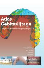 Atlas gebitsslijtage 9789036805377, Verzenden