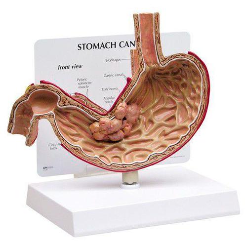 Anatomisch maagmodel pathologie ST-ATM 78, Diversen, Verpleegmiddelen, Verzenden