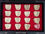 1970s Ruthinium maletín odontología • Moldes dentales