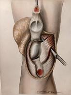 Onbekende kunstenaar - Tavole di anatomia chirurgica (14)