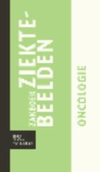 Zakboek ziektebeelden / Oncologie / Zakboek Ziektebeelden, Verzenden, Gelezen, Karin Linden