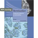Borstkanker 9789085620068 D.F. Hayes, Boeken, Verzenden, Zo goed als nieuw, D.F. Hayes