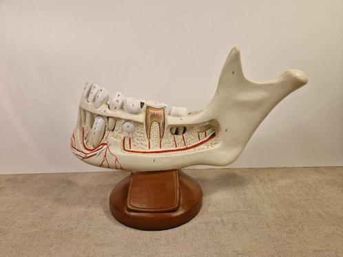 Anémomètre - plastique - 1970-1980 - Modèle anatomique de la, Antiek en Kunst, Antiek | Wandborden en Tegels