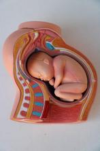 Model baarmoeder met ongeboren kind, Hong Kong - Medische