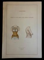 E. Lartaud - Plaques de couleur: Orthopédie. Déviation du