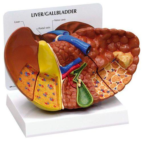 Anatomisch model leverpathologie ST-ATM 90, Diversen, Verpleegmiddelen, Verzenden