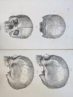 Louis- Francisque Lélut - La phrénologie. Son histoire, ses