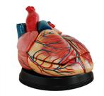 Anatomisch model hart, vier keer levensgrote ST-ATM 75, Nieuw, Verzenden