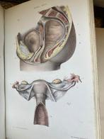 Adolphe Lenoir - Atlas de lart des accouchements - 1881