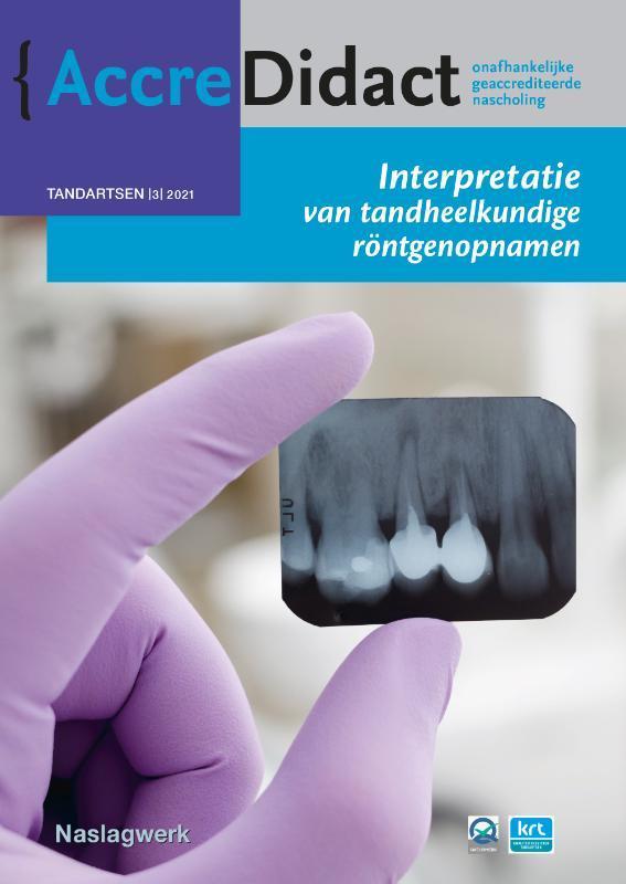 Interpretatie van tandheelkundige röntgenopnamen /, Boeken, Wetenschap, Zo goed als nieuw, Verzenden