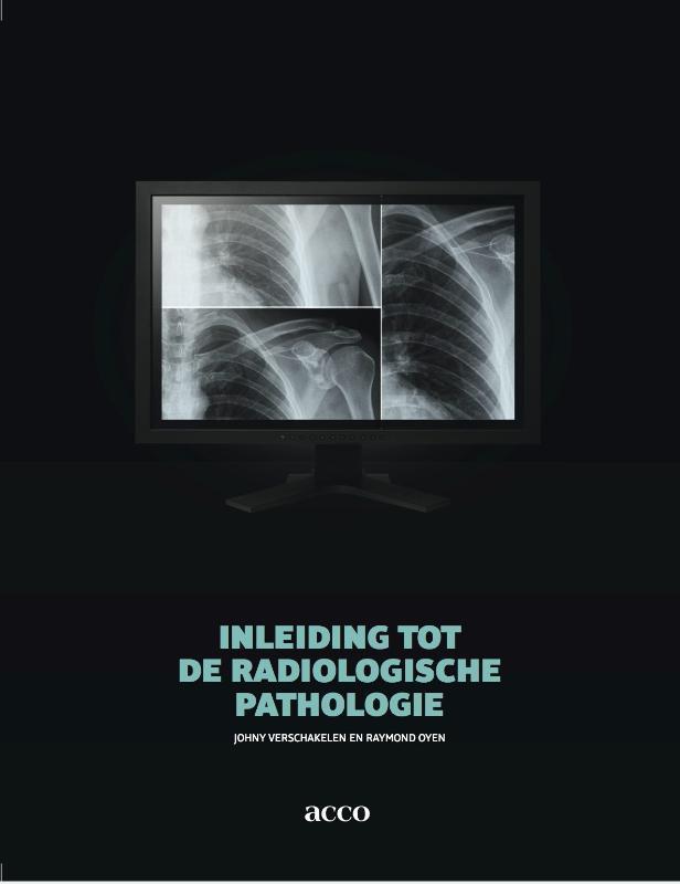 Inleiding tot de radiologische pathologie 9789033489860, Livres, Science, Envoi