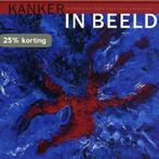 Kanker in beeld 9789071123719 Jan Taal, Verzenden, Gelezen, Jan Taal