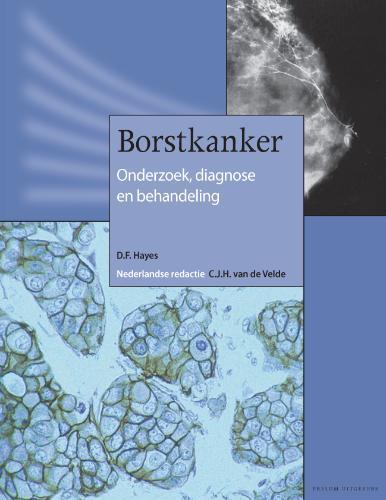 Borstkanker 9789085620068, Livres, Science, Envoi