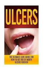 Migan, Wade : Ulcers: The Ultimate Cure Guide for How, Wade Migan, Verzenden