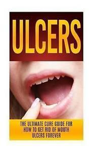 Migan, Wade : Ulcers: The Ultimate Cure Guide for How, Boeken, Overige Boeken, Gelezen, Verzenden