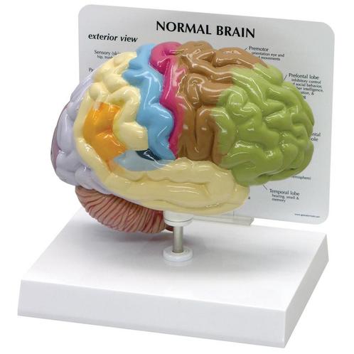 Anatomisch model hersenen in kleur ST-ATM 58, Diversen, Verpleegmiddelen, Verzenden