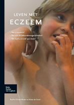 Leven met eczeem 9789031387168, Zo goed als nieuw, P.E. Dirven-Meyer, Anton  C. De Groot, Verzenden