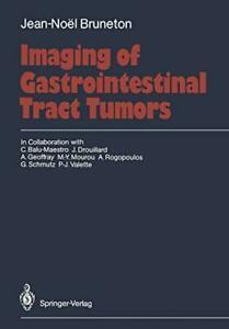 Imaging of Gastrointestinal Tract Tumors. Balu-Maestro, C., Livres, Livres Autre, Envoi