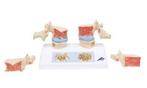 Anatomisch model osteoporose ST-ATM 45, Verzenden, Nieuw