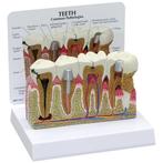 Anatomisch model voor tandheelkundige pathologieën ST-ATM 12, Verzenden