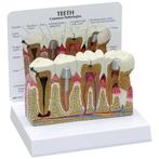 Anatomisch model voor tandheelkundige pathologieën ST-ATM 12, Verzenden, Nieuw