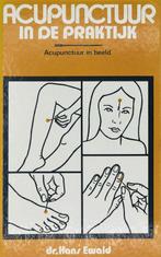 Acupunctuur in de praktijk 9789060844397, Gelezen, Hans Ewald, Ilse Dorren, Verzenden