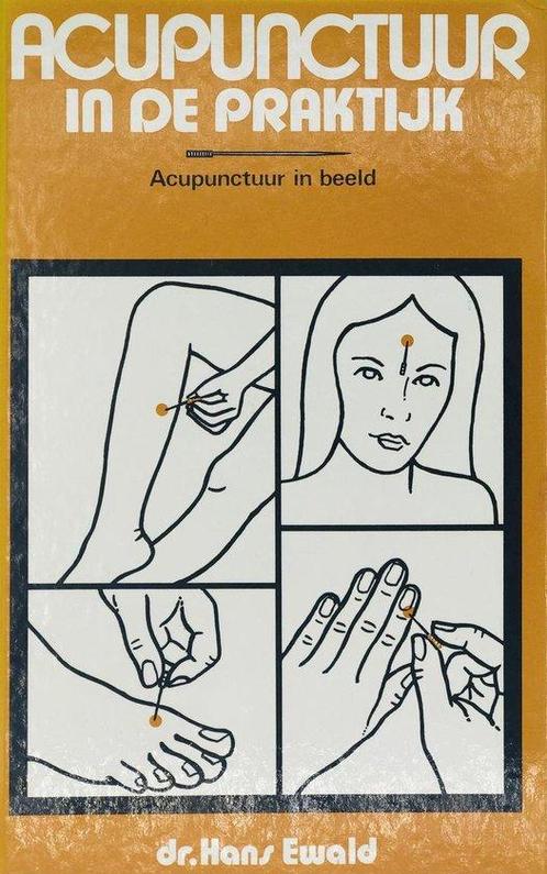 Acupunctuur in de praktijk 9789060844397, Boeken, Overige Boeken, Gelezen, Verzenden
