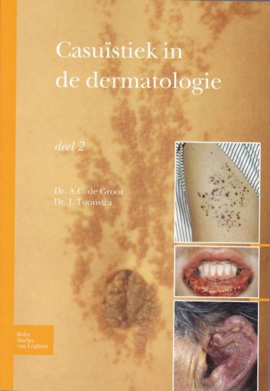 Casuïstiek in de dermatologie 9789031384570 A.C. Groot, Boeken, Wetenschap, Gelezen, Verzenden